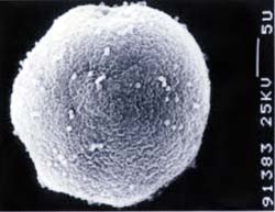 オスミウムコーターを利用して撮影したスギ花粉の撮影例